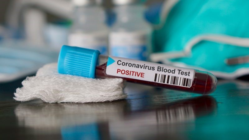 Vial of blood market with a positive coronavirus test