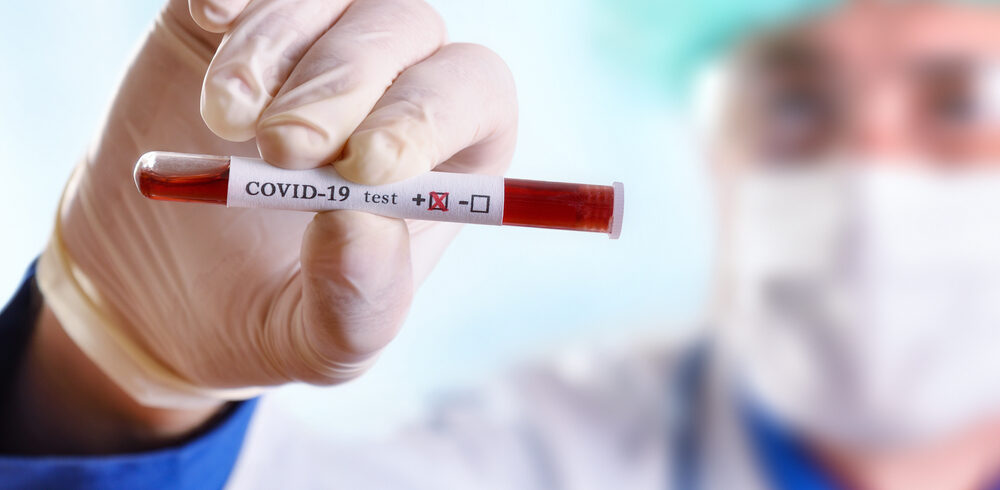 Man in medical scrubs holding a positive coronavirus blood test towards the camera