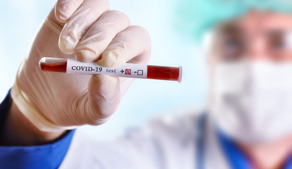Man in medical scrubs holding a positive coronavirus blood test towards the camera