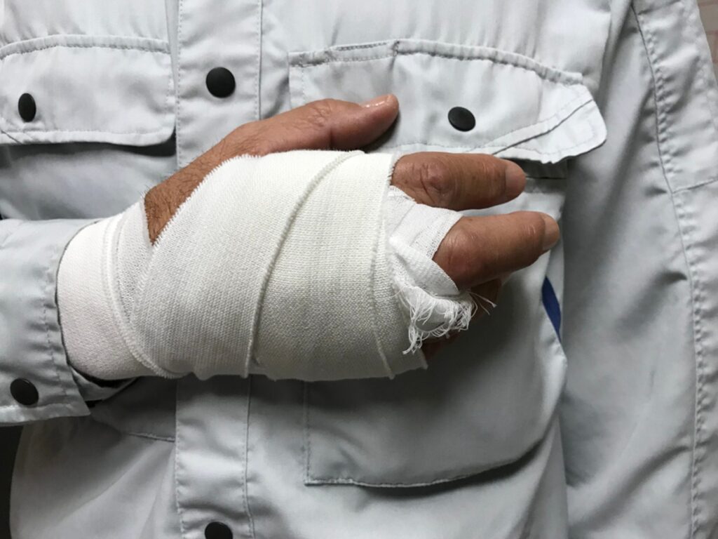 A man holding his bandaged hand against his chest, dressed in a white shirt with black buttons.